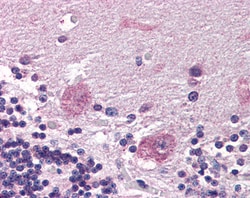 Invitrogen PPP2R3A Polyclonal Antibody 100 &mu;g; Unconjugated:Antibodies,