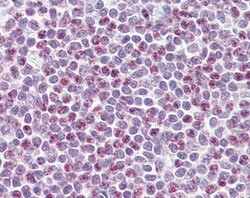 Invitrogen APOBEC3A Polyclonal Antibody 100 &mu;g | Buy Online | Invitrogen&trade; | Fisher Scientific