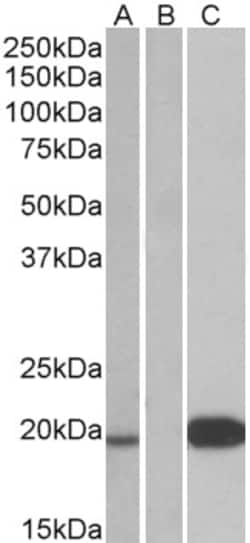Invitrogen UCN3 Polyclonal Antibody 100 &mu;g; Unconjugated:Antibodies,
