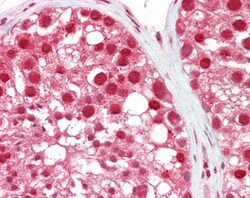 Invitrogen MSH5 Polyclonal Antibody 100 &mu;g; Unconjugated:Antibodies,