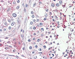 Invitrogen HRASLS Polyclonal Antibody 100 &mu;g; Unconjugated:Antibodies,