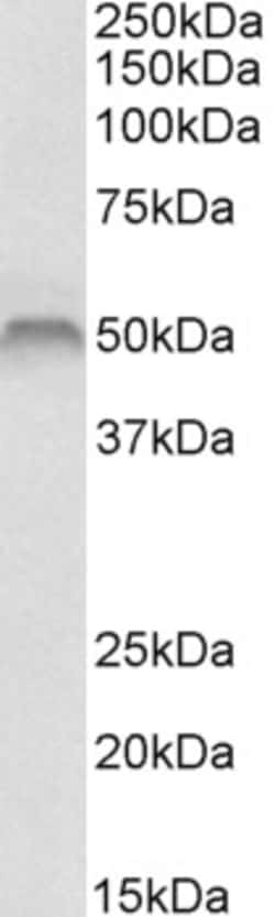Invitrogen Fascin Polyclonal Antibody 100 &mu;g; Unconjugated:Antibodies,