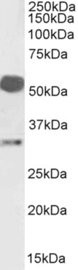 Invitrogen Estrogen Receptor beta Polyclonal Antibody 100 &mu;g; Unconjugated:Antibodies,
