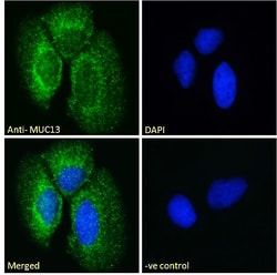 Invitrogen MUC13 Polyclonal Antibody 100 &mu;g; Unconjugated:Antibodies,