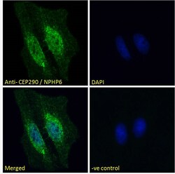 Invitrogen CEP290 Polyclonal Antibody 100 μg; Unconjugated:Antibodies,