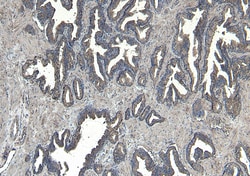 Invitrogen CEP290 Polyclonal Antibody 100 μg; Unconjugated:Antibodies,