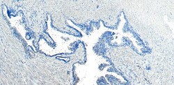 Invitrogen CEP290 Polyclonal Antibody 100 μg; Unconjugated:Antibodies,