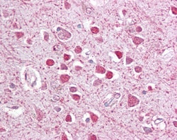 Invitrogen C/EBP gamma Polyclonal Antibody 100 &mu;g; Unconjugated:Antibodies,