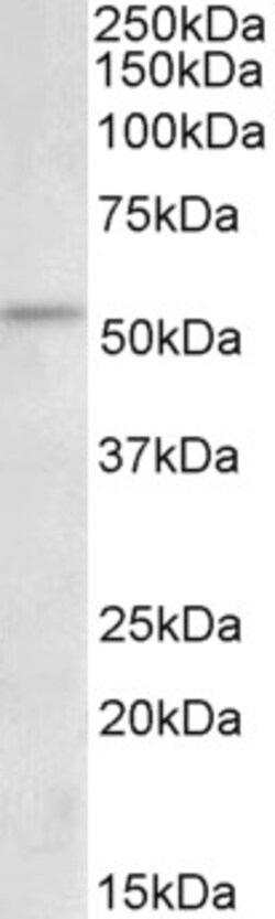 Invitrogen Chk1 Polyclonal Antibody 100 &mu;g; Unconjugated:Antibodies,