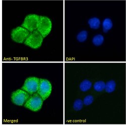 Invitrogen TGFBR3 Polyclonal Antibody 100 μg; Unconjugated:Antibodies,