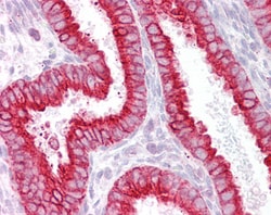 Invitrogen CHRNB4 Polyclonal Antibody 100 &mu;g; Unconjugated:Antibodies,