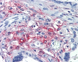 Invitrogen SLC46A1 Polyclonal Antibody 100 &mu;g; Unconjugated:Antibodies,