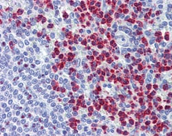 Invitrogen RASSF2 Polyclonal Antibody 100 &mu;g; Unconjugated:Antibodies,