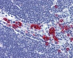 Invitrogen RASSF2 Polyclonal Antibody 100 &mu;g; Unconjugated:Antibodies,