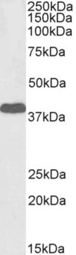 Invitrogen EPM2A Polyclonal Antibody, Biotin 100 &mu;g; Biotin:Antibodies,