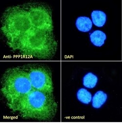 Invitrogen MYPT1 Polyclonal Antibody 100 &mu;g; Unconjugated:Antibodies,