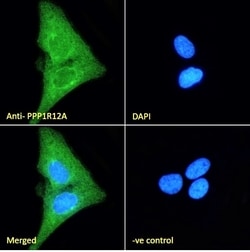 Invitrogen MYPT1 Polyclonal Antibody 100 &mu;g; Unconjugated:Antibodies,