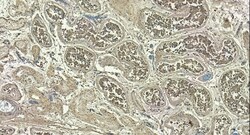 Invitrogen MYPT1 Polyclonal Antibody 100 &mu;g; Unconjugated:Antibodies,