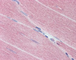 Invitrogen MYPT1 Polyclonal Antibody 100 &mu;g; Unconjugated:Antibodies,