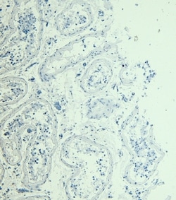 Invitrogen MYPT1 Polyclonal Antibody 100 &mu;g; Unconjugated:Antibodies,