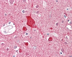 Invitrogen ABCA2 Polyclonal Antibody 100 &mu;g | Buy Online | Invitrogen&trade; | Fisher Scientific
