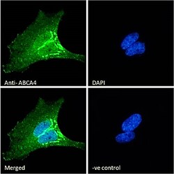 Invitrogen ABCA4 Polyclonal Antibody 100 &mu;g; Unconjugated:Antibodies,