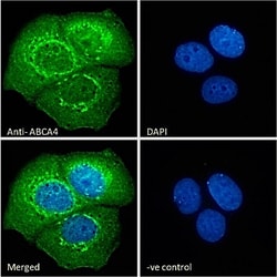 Invitrogen ABCA4 Polyclonal Antibody 100 &mu;g; Unconjugated:Antibodies,