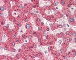 Invitrogen HRASLS2 Polyclonal Antibody 100 &mu;g; Unconjugated:Antibodies,