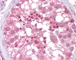 Invitrogen USP28 Polyclonal Antibody 100 &mu;g; Unconjugated:Antibodies,