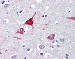 Invitrogen USP9X Polyclonal Antibody 100 &mu;g; Unconjugated:Antibodies,