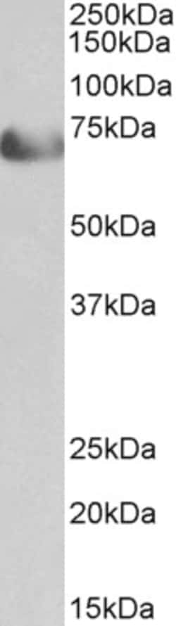 Invitrogen TCF4 Polyclonal Antibody 100 &mu;g; Unconjugated:Antibodies,