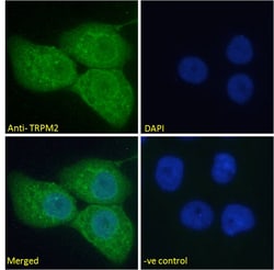 Invitrogen TRPM2 Polyclonal Antibody 100 &mu;g; Unconjugated:Antibodies,