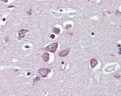 Invitrogen TRPM2 Polyclonal Antibody 100 &mu;g; Unconjugated:Antibodies,