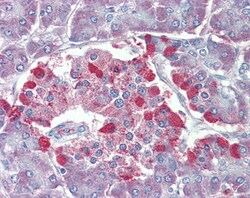 Invitrogen TRPM2 Polyclonal Antibody 100 &mu;g; Unconjugated:Antibodies,