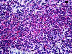 Invitrogen ITK Polyclonal Antibody 100 &mu;g; Unconjugated:Antibodies,