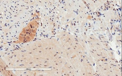 Invitrogen GPR120 Polyclonal Antibody 100 μg; Unconjugated:Antibodies,