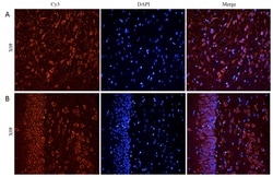 Invitrogen CHRNA7 Polyclonal Antibody 100 μg; Unconjugated:Antibodies,