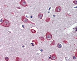 Invitrogen CHRNA7 Polyclonal Antibody 100 μg; Unconjugated:Antibodies,