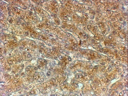 Invitrogen ATG4A Polyclonal Antibody 100 &mu;g; Unconjugated:Antibodies,