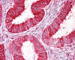 Invitrogen SCNN1D Polyclonal Antibody 100 &mu;g; Unconjugated:Antibodies,