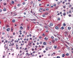 Invitrogen PCSK6 Polyclonal Antibody 100 &mu;g; Unconjugated:Antibodies,