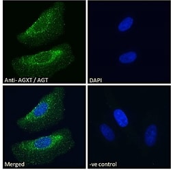Invitrogen AGXT Polyclonal Antibody 100 &mu;g; Unconjugated:Antibodies,
