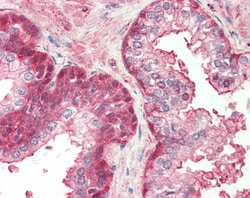 Invitrogen RCBTB2 Polyclonal Antibody 100 &mu;g; Unconjugated:Antibodies,