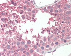 Invitrogen RCBTB2 Polyclonal Antibody 100 &mu;g; Unconjugated:Antibodies,