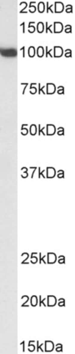 Invitrogen SP1 Polyclonal Antibody 100 &mu;g; Unconjugated:Antibodies,
