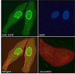 Invitrogen E2F8 Polyclonal Antibody 100 &mu;g | Buy Online | Invitrogen&trade; | Fisher Scientific