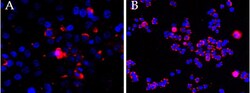 Invitrogen CEP290 Polyclonal Antibody 100 &mu;g; Unconjugated:Antibodies,