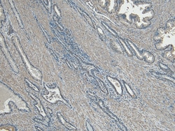 Invitrogen CEP290 Polyclonal Antibody 100 &mu;g; Unconjugated:Antibodies,