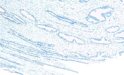 Invitrogen CEP290 Polyclonal Antibody 100 &mu;g; Unconjugated:Antibodies,