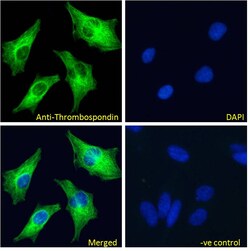 Thrombospondin 1 Polyclonal Antibody:Antibodies, Polyclonal